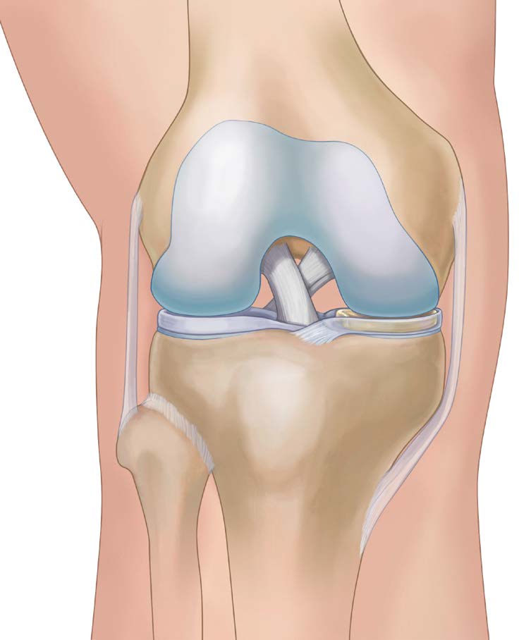 Each knee has two menisci, that help to stabilize the joint and distribute load between your upper and lower leg.